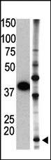 WB - SUMO2 Antibody (C-term) AP1282a